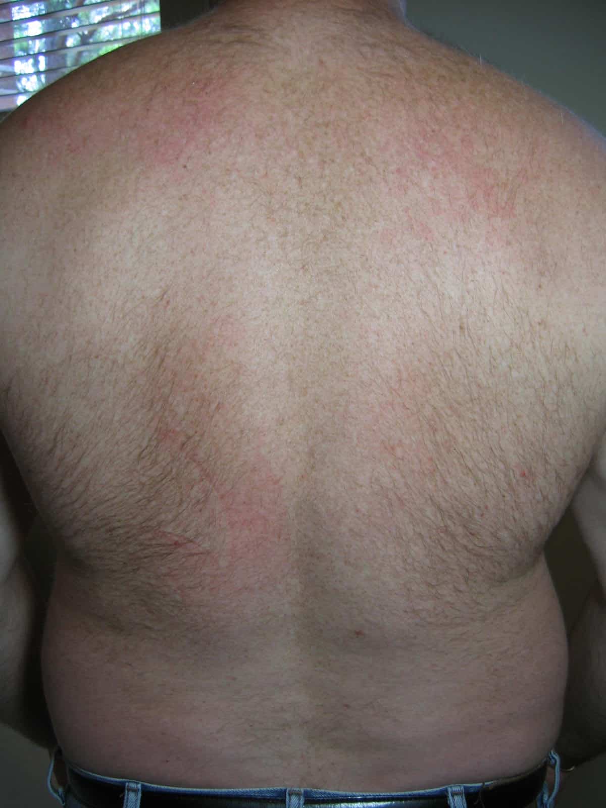 Back, before