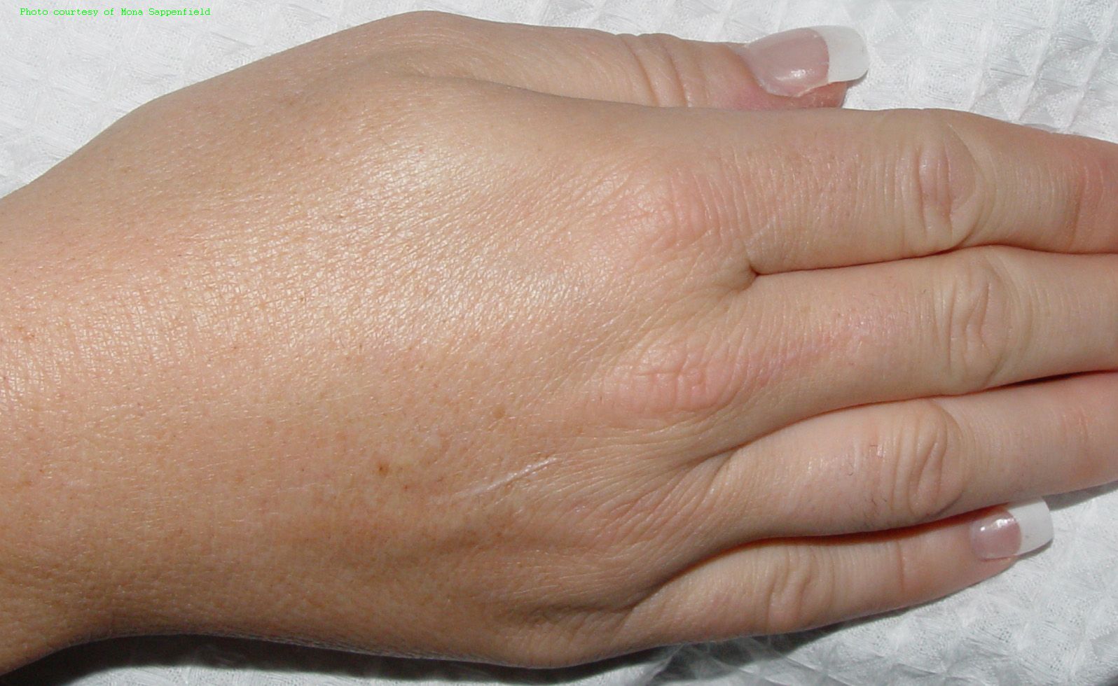 Hand, after