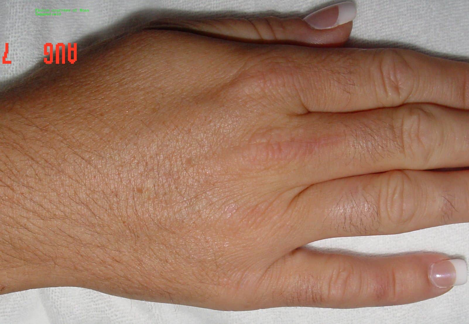 Hand, before