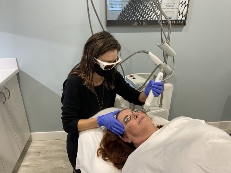 Laser Genesis Mount Pleasant SC Top Laser Skin Rejuvenation