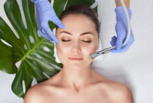 Microdermabrasion Avian Park SC