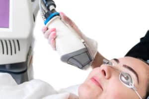 Laser treatment being performed on female patient for face rejuv