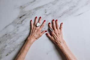 Treatment options for aging hands