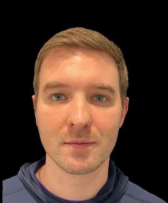 After Image: Botox & Filler - front