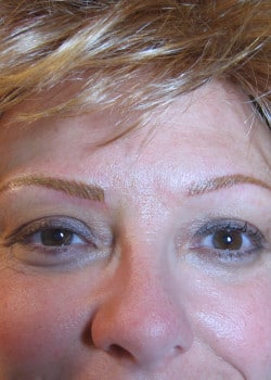 After Image: Permanent Makeup Eyebrows – Case 1 - front
