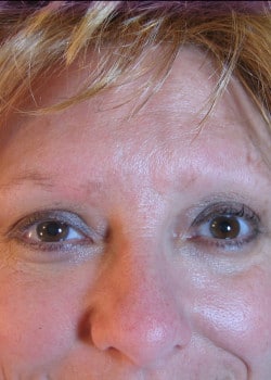 Before Image: Permanent Makeup Eyebrows – Case 1 - front